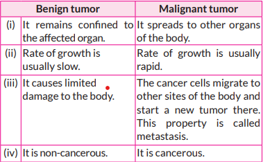 Differentiate between benign and malignant tumors.